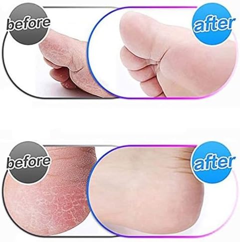 10 Pack Extra Coarse Replacement Rollers for Amope Pedi Refills Electronic Perfect Foot File Pedi Hard Skin Remover Refills