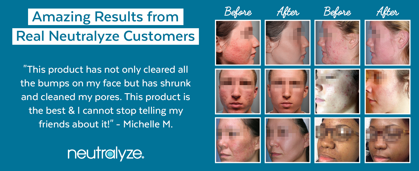 Neutralyze Amazing Results