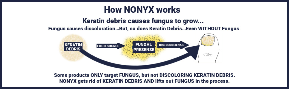 How Nonyx works by removing keratin debris so nails look clear
