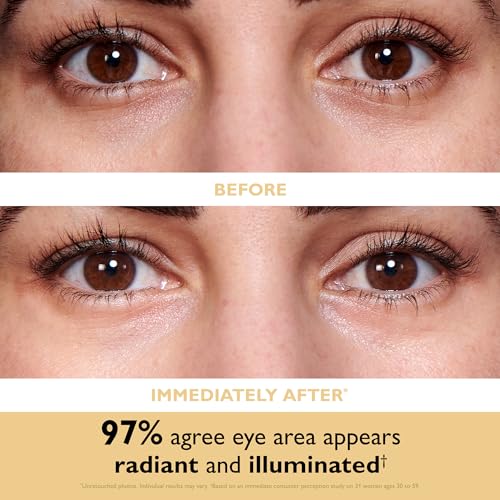 Peter Thomas Roth | 24K Gold Firming Hydra-Gel Eye Patches | Gold-Infused Eye Mask Patches for Fine Lines, Crow's Feet and Dark Circles