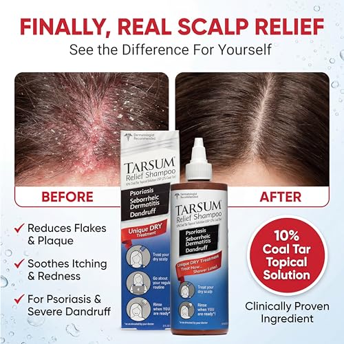 Tarsum Extra Strength Psoriasis Shampoo - Coal Tar Shampoo and Conditioner for Scalp Psoriasis, Seborrheic Dermatitis, Severe Dandruff, & Eczema - Exfoliating Relief for Flaky, & Itchy Scalp (4 oz)