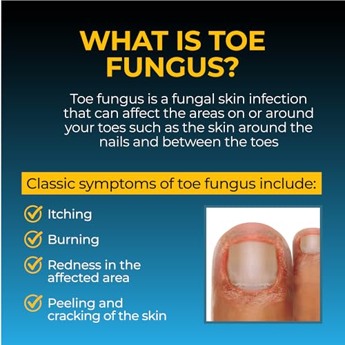 Fungi-Nail Pen Apllicator Anti-Fungal Solution 0.101 Fl Oz