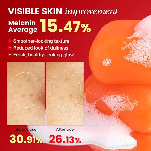 Koji White Pure Kojic Acid Soap | Glycerin Soap Bar for Gentle Skin Brightening and Exfoliation with Tea Tree, Coconut Oil