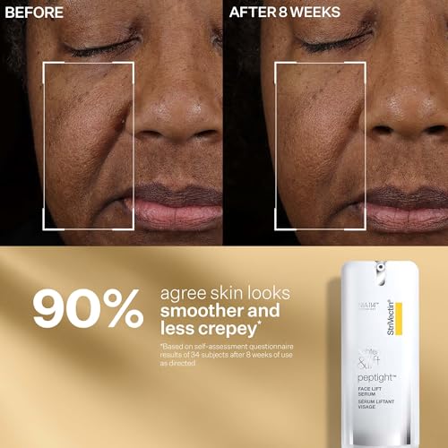 StriVectin Tighten & Lift Peptight Face Lift Serum with Tightening & Brightening Peptides for Wrinkles