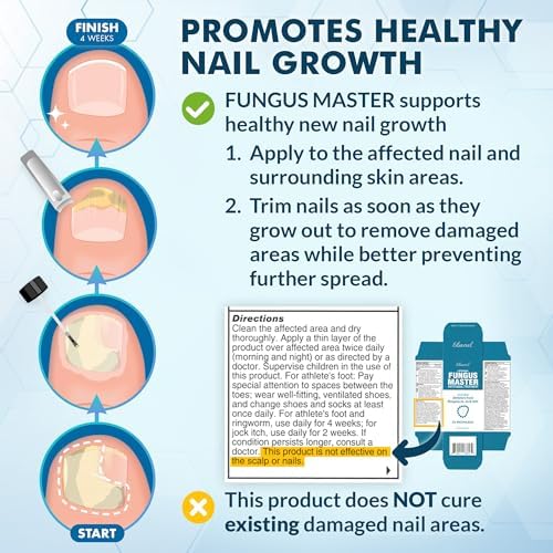 Ebanel Athlete's Foot Fungus Treatment, Miconazole Antifungal Cream 1Oz