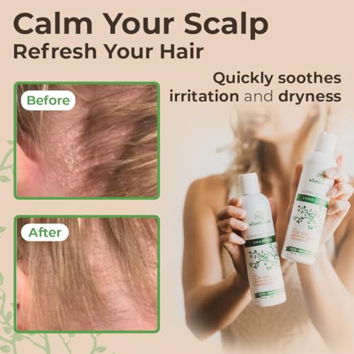 Eczema Psoriasis Shampoo & Conditioner Set for Men & Women - Anti Dandruff Shampoo for Dry Scalp & Hair - Seborrheic Dermatitis for Itchy Scalp Treatment - Eczema for Psoriasis