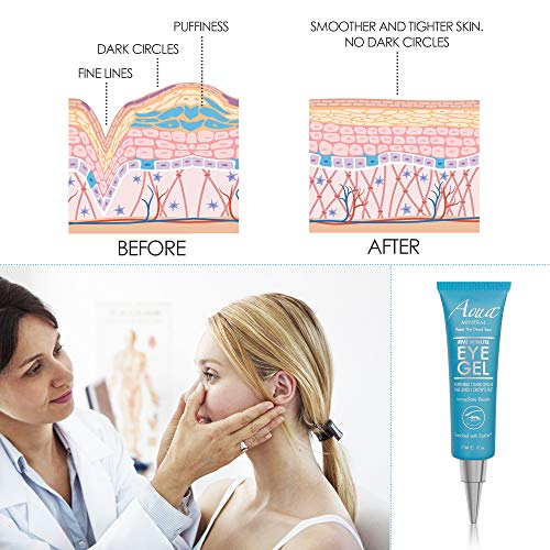 Puffy Eye GEL Instant results – Naturally rapid reduction eye gel, Eliminate Wrinkles