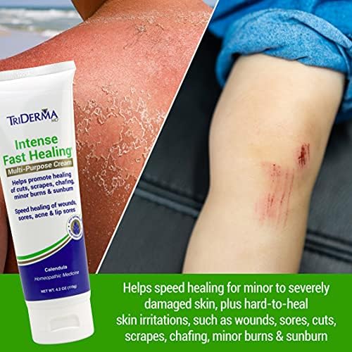 TriDerma Intense Fast Skin Healing Cream for Hard-to-Heal Skin Irritations, Sores, Rashes, Dry, Cracked Hands, Cuts, Chafing, Burns