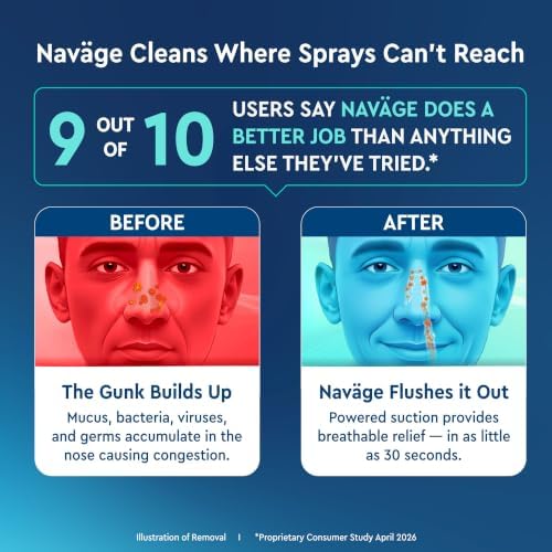 NAVAGE® Deluxe Bundle: Nose Cleaner, 30 SaltPods, Caddy, Black Bag | Deluxe Set: Powered Nose Sinus Cleaner, Storage Caddy, Batteries & Matching Black Travel Bag for Congestion & Sinus Relief