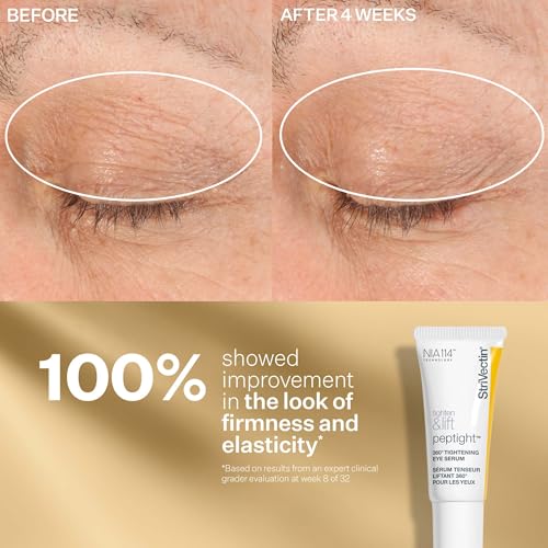 StriVectin Tighten & Lift Peptight Face Lift Serum with Tightening & Brightening Peptides for Wrinkles