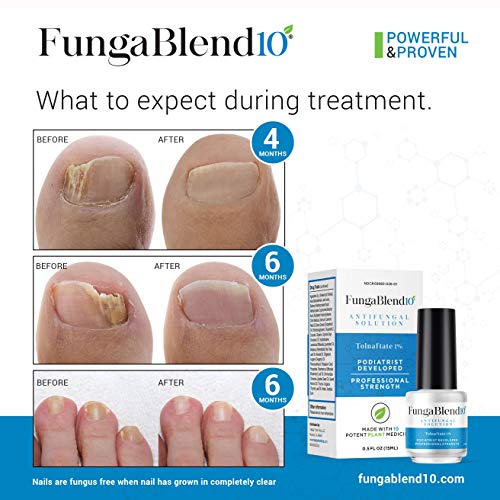 FungaBlend 10 - Antifungal Medication:1% Tolnaftate and 10 Plant Medicines -Toenail Fungus Treatment for Nail Repair Gel, Athletes Foot, Jock Itch