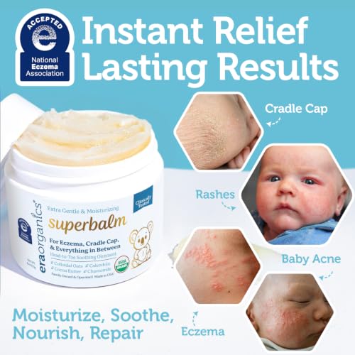 Superbalm USDA Organic Healing Ointment for Baby Eczema & Cradle Cap - 2oz | 100% Natural Soothing Superfood Cream for Toddler & Kids - Eczema, Cradle Cap, Baby Acne & Rashes - Non-Toxic, Fragrance-Free