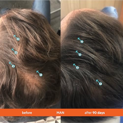 DS Labs Revita Hair Density Shampoo & Conditioner for Thinning Hair, 205 mL | Complete hair care routine powered by peptides, turmeric, caffeine & ginseng for healthier-looking, fuller-looking hair.
