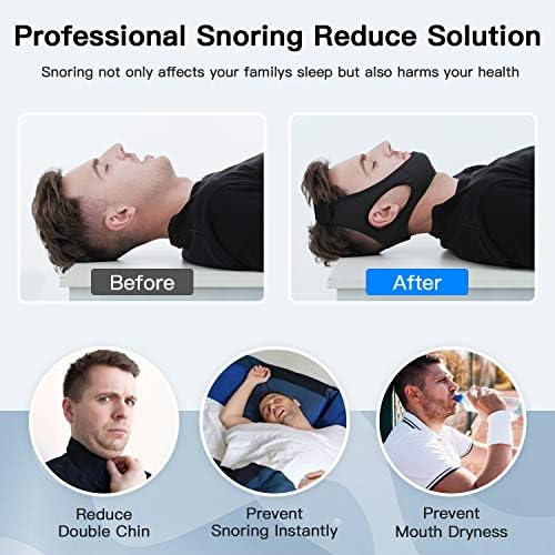 Anti Snore Chin Strap [Upgraded], Vosaro Snoring Solution Effective Anti Snore Device, Adjustable and Breathable Stop Snoring Head Band for Men Women