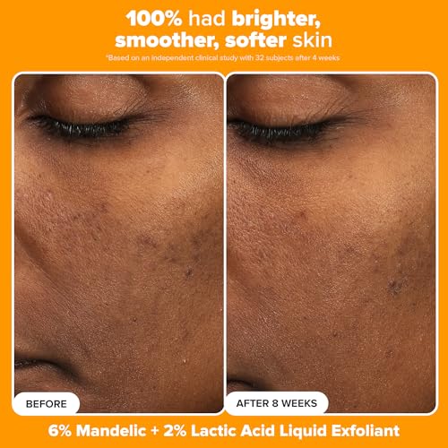 Paula's Choice BOOST C15 Super Booster 15% Vitamin C Face Serum | Daily Serum with Vitamin E & Ferulic Acid for Discoloration & Glow, Fragrance-Free