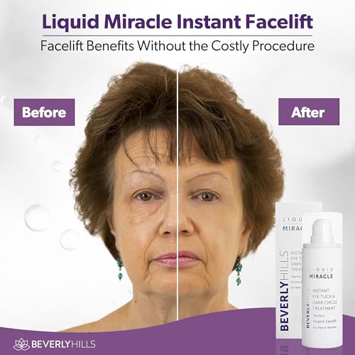 Beverly Hills Instant Facelift Anti Aging Eye Serum Treatment for Dark Circles, Puffy Eyes, Wrinkles, Under Eye Bags, Fine Lines