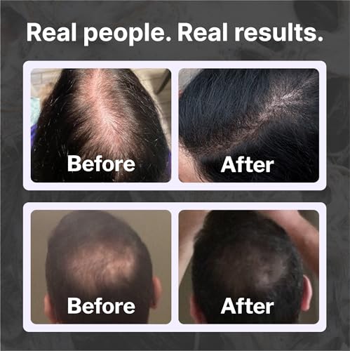 Shapiro MD Hair Growth Experts Natural Hair Kit for Thicker Looking Hair