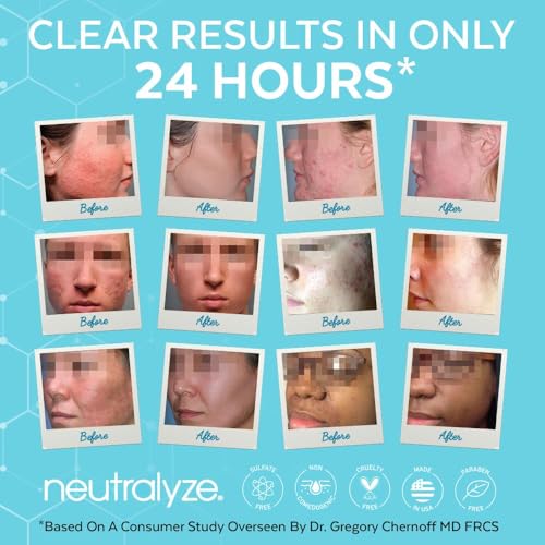 Neutralyze Acne Moisturizer with Time-Release Salicylic Acid, 3.4 fl oz