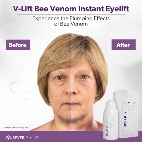 Beverly Hills V-Lift Instant Eye Lift and Eye Tuck Bee Venom Serum for Puffy Eyes, Dark Circles, Wrinkles