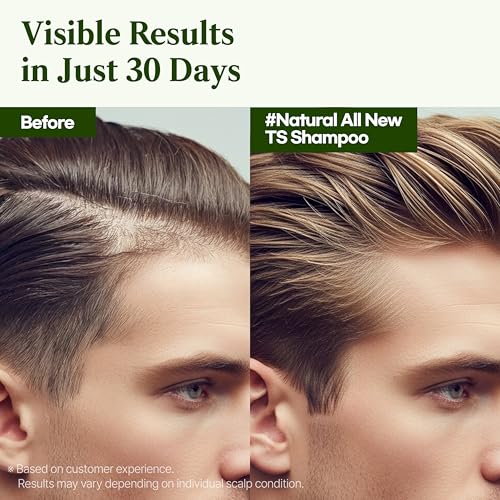 TS Natural All New TS Shampoo | Korean Shampoo for Sensitive Scalp | Hair & Scalp Care with Salicylic Acid and Natural Ingredients | Sulfate-Free