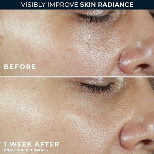 RoC Multi Correxion Revive + Glow 10% Vitamin C Face Moisturizer, 1.7 oz