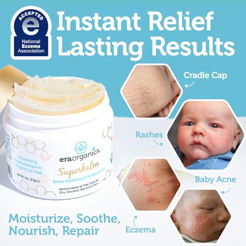 Superbalm USDA Organic Healing Ointment for Baby Eczema & Cradle Cap - 2oz | 100% Natural Soothing Superfood Cream for Toddler & Kids - Eczema, Cradle Cap, Baby Acne & Rashes - Non-Toxic, Fragrance-Free