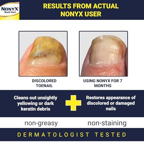 NONYX Fungal Nail Clarifying Gel | Clinically Proven for Discolored, Thick, Brittle, Yellow, Lifted