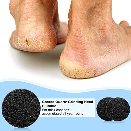 BBTO 20 Pcs Foot File Replacement Pads for Replacement Pads Portable Electric Vacuum Callus Remover Foot File for Exfoliation Cracked Heels Dead Skin