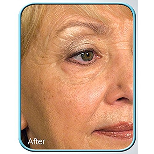 Stem Cell Therapy by BioLogic Solutions Grow Smooth Supple Firm New Skin (Set Of 2 Jars)