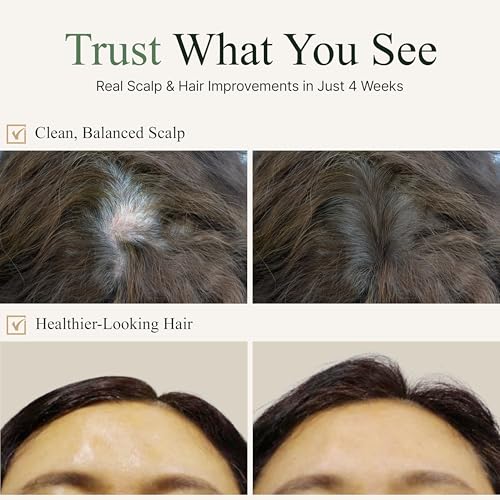 TS Gold Plus Shampoo | Hair Loss Shampoo with Biotin