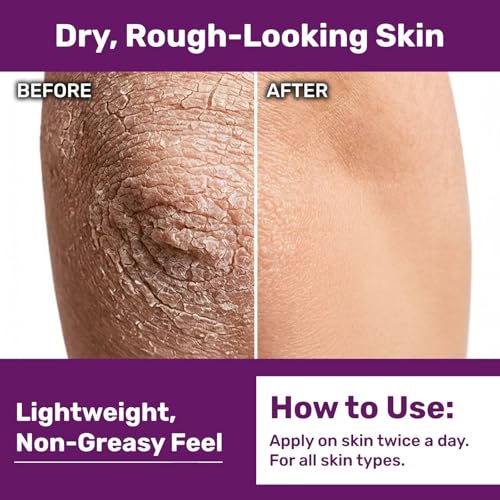 Immuderm Beta Glucan Serum - Daily Moisturizer for Dry Skin - 6 fl oz | Beta-Glucan Power Moisturizer with Natural Moisturizing Factors - Lightweight