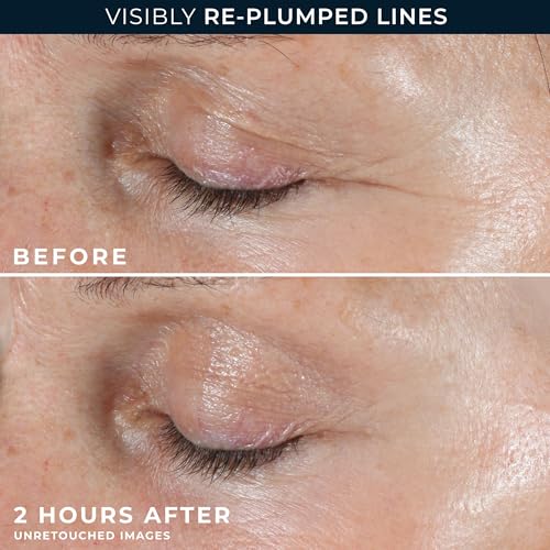 RoC Retinol Correxion Wrinkle Filler for Deep Wrinkles with Hyaluronic Acid | 1oz retinol serum for face, skin care for women and men, visibly reduce fine lines, clinically proven, packaging may vary