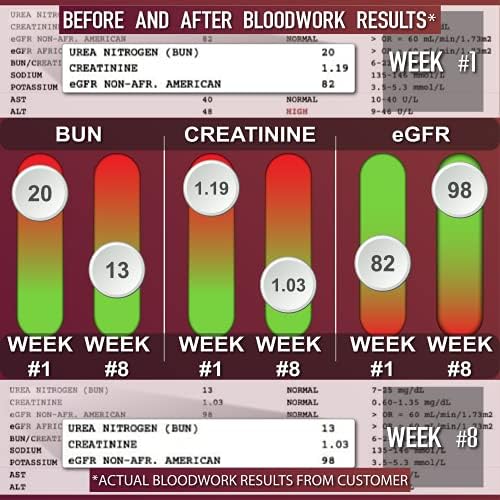 Leviathan Super Kidney Cleanse & Urinary Detox Formula | Optimal Kidney Health & Gallbladder Formula | Full Restore & Detox - Manage Kidney Stones