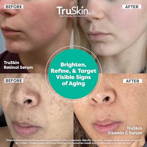 TruSkin Face Serum Duo - Vitamin C Serum & Retinol Serum for Face - AM & PM Anti Aging Skincare Routine - Brightening & Smoothing Facial Serums