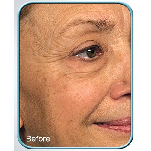 STEM CELL THERAPY CREAM BY BIOLOGIC 1oz JAR
