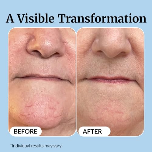 Vibriance Super C Vitamin C Serum for Mature Skin, 1 fl oz