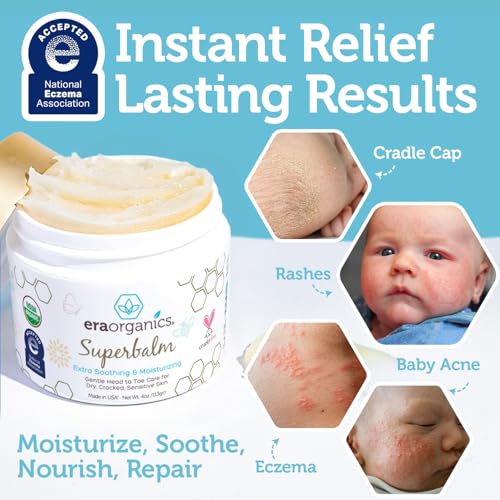 Superbalm USDA Organic Healing Ointment for Baby Eczema & Cradle Cap - 2oz | 100% Natural Soothing Superfood Cream for Toddler & Kids - Eczema, Cradle Cap, Baby Acne & Rashes - Non-Toxic, Fragrance-Free