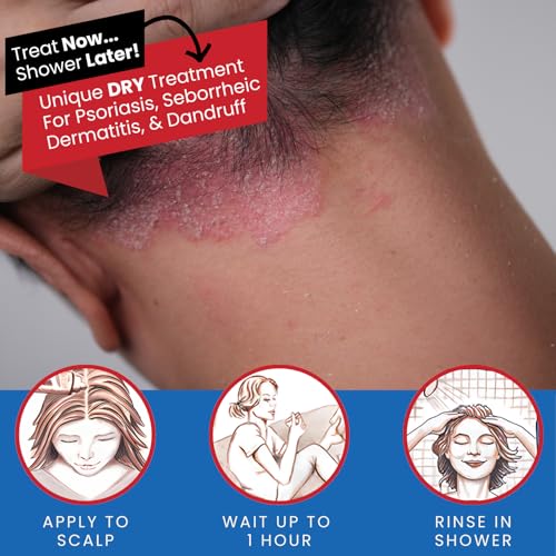 Tarsum Extra Strength Psoriasis Shampoo - Coal Tar Shampoo and Conditioner for Scalp Psoriasis, Seborrheic Dermatitis, Severe Dandruff, & Eczema - Exfoliating Relief for Flaky, & Itchy Scalp (4 oz)