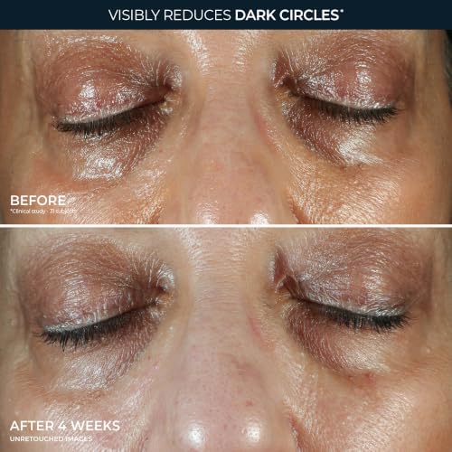 RoC Brightening 5 in 1 Eye Cream Multi Correxion Even Tone + Lift, 0.5oz | 0.5 oz Under eye cream for under eye bags & dark circles