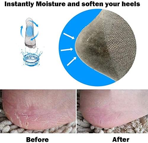 Codream Vented Moisturizing Socks Lotion Gel for Dry Cracked Heels 2 Pairs | Spa Gel Socks Humectant Moisturizer Heel Balm Foot Treatment Care Heel