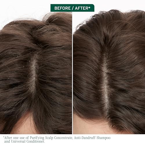 Biolage Scalp Sync Anti-Dandruff Shampoo – Controls Dandruff | Controls Itchy Scalp, Cleanses Hair, Moisturizing, Dandruff Relief, For Scalp and Hair Health, Vegan & Cruelty-Free