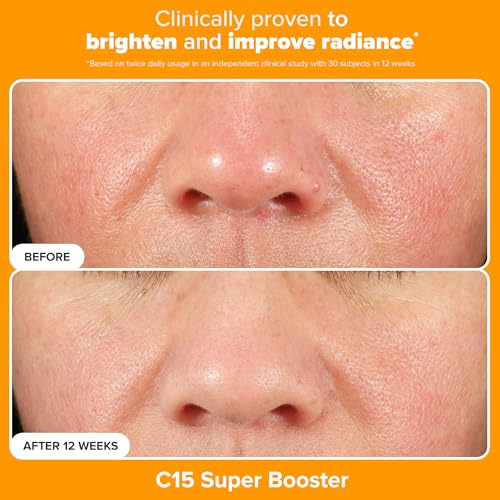 Paula's Choice BOOST C15 Super Booster 15% Vitamin C Face Serum | Daily Serum with Vitamin E & Ferulic Acid for Discoloration & Glow, Fragrance-Free