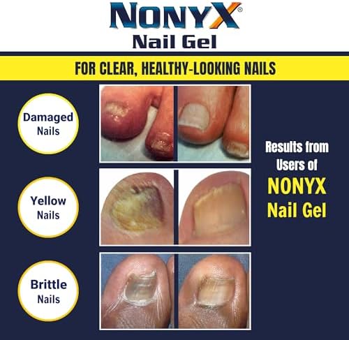 NONYX Fungal Nail Clarifying Gel | Clinically Proven for Discolored, Thick, Brittle, Yellow, Lifted
