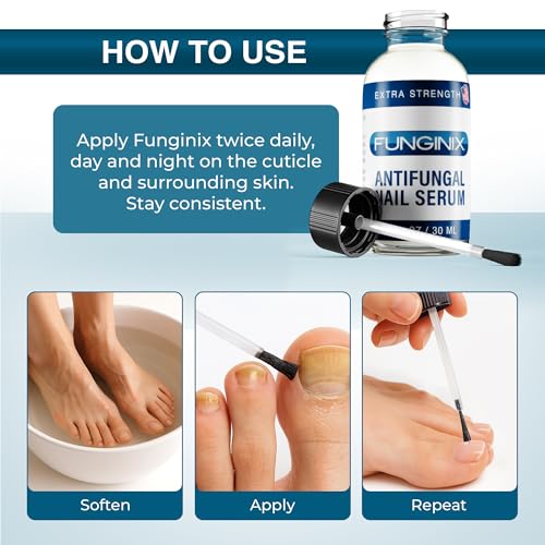 FUNGINIX Toenail Fungus Treatment Extra Strength - Antifungal Nail Treatment With 10% Undecylenic Acid & Tea Tree Oil - Includes Natural Oils & Botanicals - Made in USA (Packaging Does Vary)