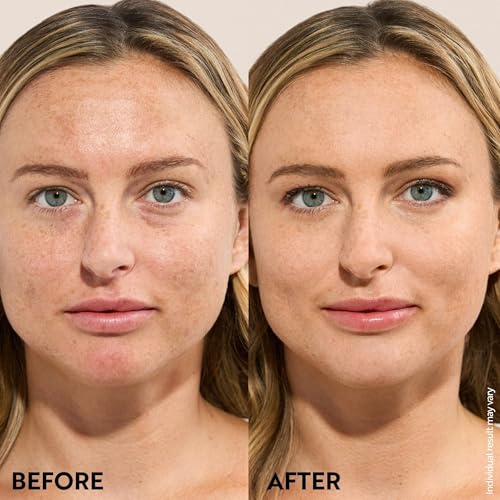 M. Asam Magic Finish Make-up Mousse (1.01 Fl Oz) | 4in1 Primer, Foundation, Concealer & Powder With Buildable Coverage, Hides Redness And Dark Spots, Light To Medium Skin