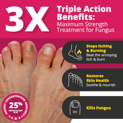 Better Nail - Treatment for Fungus Under & Around the Nail - Maximum Strength, 25% Anti Fungal Solution for Nail Support, Nail Restoring