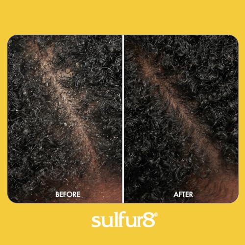 SULFUR8 Anti-Dandruff Shampoo for Kids 7.5 oz – Gentle Medicated Dandruff Control for Itchy Scalp, Mild Cleanse with Kid-Friendly Fresh Fragrance for Children & Sensitive Scalps