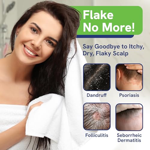 Sulfate Free Shampoo and Conditioner Set for Seborrheic Dermatitis Relief - Severe Dry & Itchy Scalp Treatment with Manuka Honey, Aloe Vera & Coconut Oil - Safe for Color Treated Hair (8 oz)