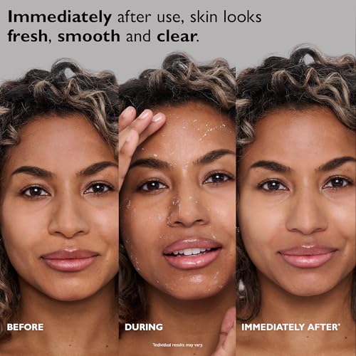 Peter Thomas Roth | FIRMx® Peeling Gel | Gentle Facial Exfoliant for Dullness, Pores and Uneven Texture