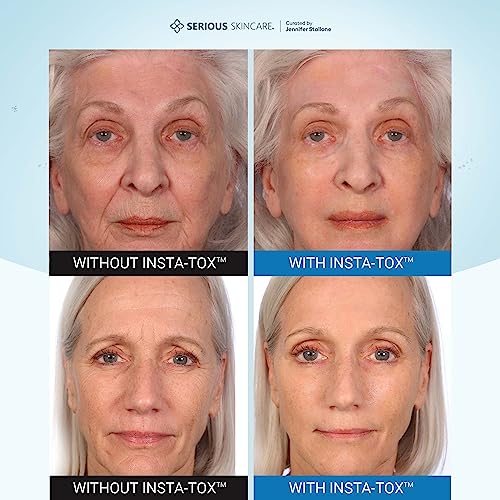Serious Skincare INSTA-TOX Instant Wrinkle Filler for Face Serum, to Smooth + Blur Fine Lines, Deep Wrinkles, Lip Lines, Crow’s Feet & Pores, Temporary Face Tightener, for Smoother Skin .75 oz